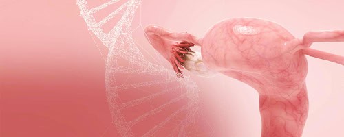 Endometrial-Scratching-image